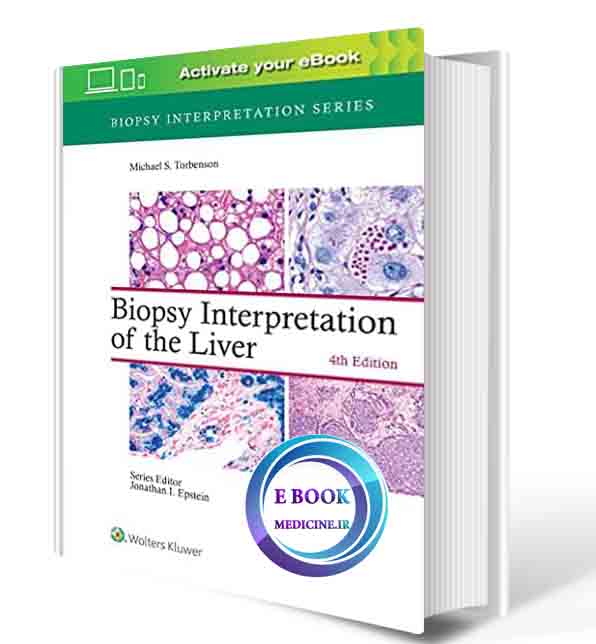 دانلود کتابBiopsy Interpretation of the Liver (Biopsy Interpretation Series) 2021 (ORIGINAL PDF)